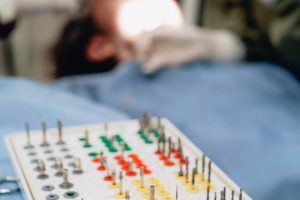 해외 치과 임플란트 시술 이미지