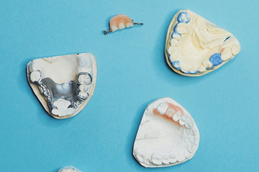 해외 치과 임플란트 시술 이미지